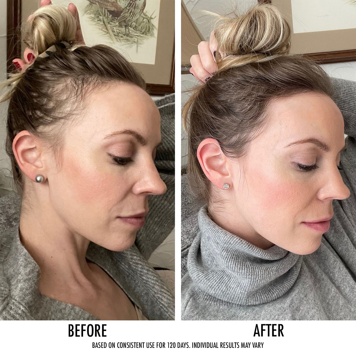 The Hair Growth Treatment