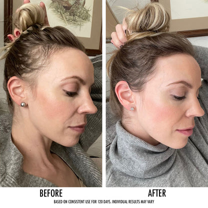 The Hair Growth Treatment